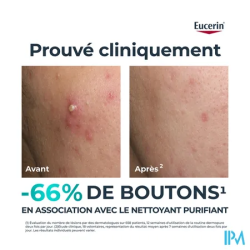EUCERIN DERMOPURE TRIPLE ACTION