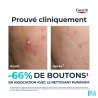 EUCERIN DERMOPURE TRIPLE ACTION