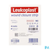 LEUKOPLAST WOUND CLO STRIP 6X100MM