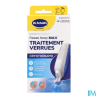 SCHOLL TRAITEMENT VERRUES