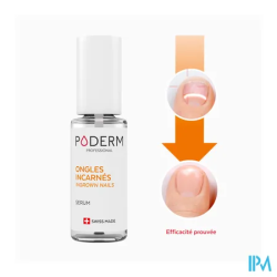 PODERM ONGLE INCARNE APAISANT 8ML