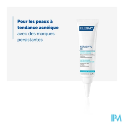 KERACNYL PP+ A/IMPERF 30ML