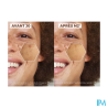 A-DERMA EPITHELIALE SERUM ECLAT 30