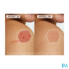 A-DERMA EPITHELIALE ULTRA REP 40ML