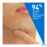 CERAVE PATCH A/IMPERFECTION BTE22