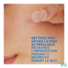 CERAVE PATCH A/IMPERFECTION BTE22